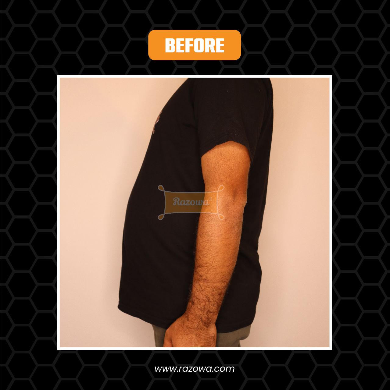 Zuko Men's Girdle | Razowa | Before